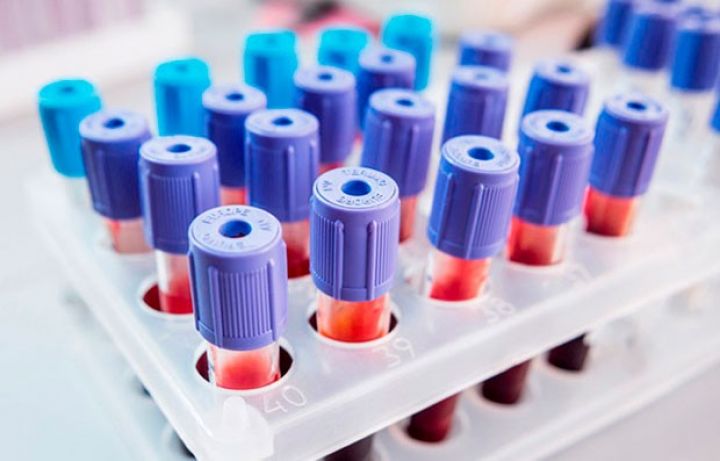 6 əczaçılıq şirkəti 8,5 milyon manatlıq tenderlərin qalibi elan edilib