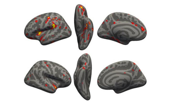 Koronavirus beyin toxumalarımızı məhv edir - YENİ ARAŞDIRMA