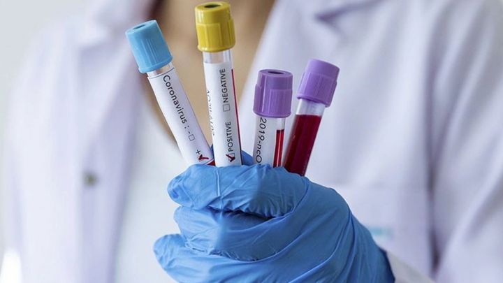 Azərbaycanda koronavirus ilə bağlı son vəziyyət açıqlandı