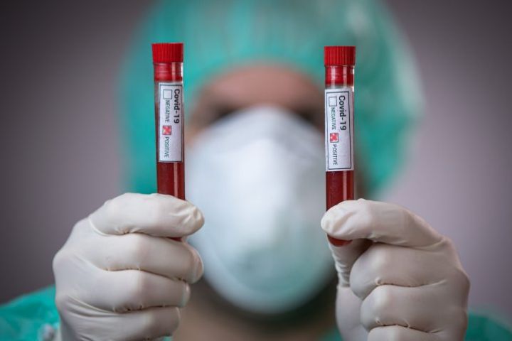 Azərbaycanda koronavirus ilə bağlı son vəziyyət açıqlandı