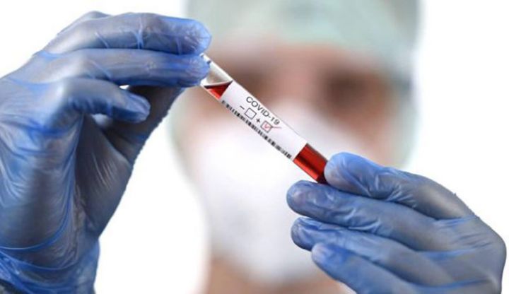 Azərbaycanda koronavirus ilə bağlı son vəziyyət açıqlandı