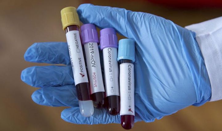 Koronavirusun mənşəyini araşdıracaq heyətin Çinə girişinə icazə verilmədi