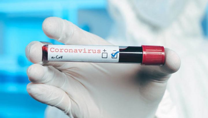 Azərbaycanda koronavirus ilə bağlı son vəziyyət açıqlandı